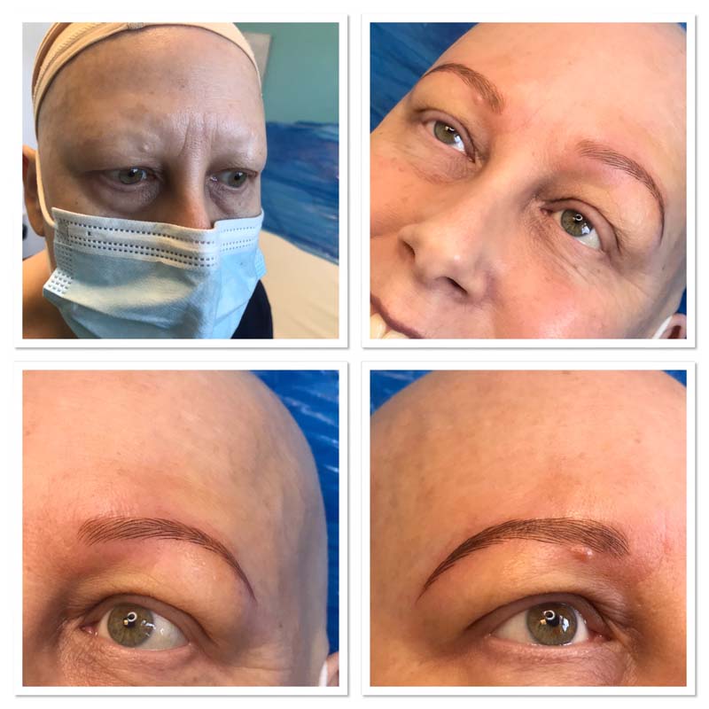 Free Cancer patient clients hair stroke brows